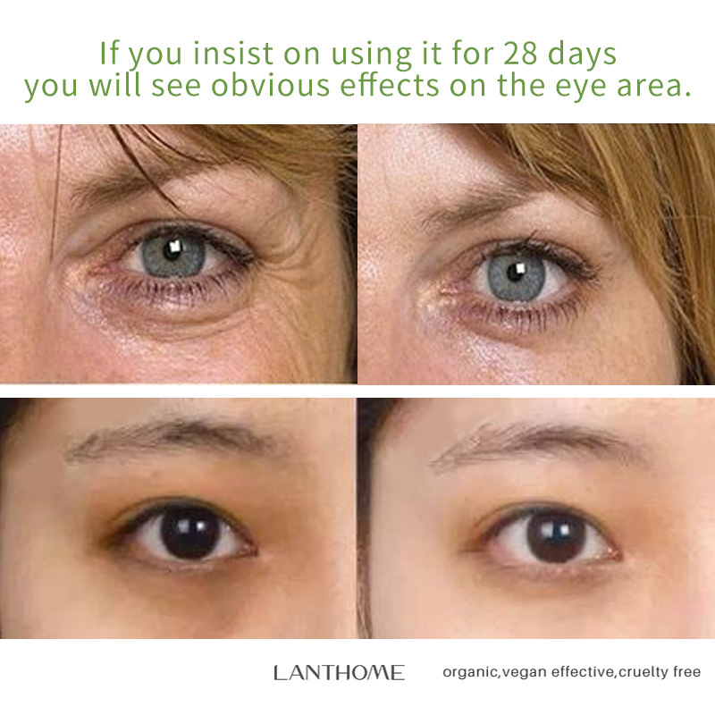 Caffeine Eye Cream - Fades Dark Circles - Image 4